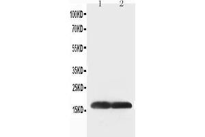 Anti-Superoxide Dismutase 1 antibody, Western blotting Lane 1: COLO320 Cell Lysate Lane 2: SMMC Cell Lysate (SOD1 anticorps  (C-Term))