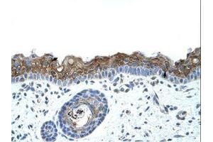 Image no. 1 for anti-Zinc Finger Protein 397 (ZNF397) (C-Term) antibody (ABIN202144) (ZNF397 anticorps  (C-Term))
