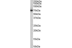 Western Blotting (WB) image for anti-phosphoenolpyruvate Carboxykinase 2 (Mitochondrial) (PEPCK) (AA 407-419) antibody (ABIN299543) (PEPCK anticorps  (AA 407-419))