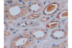 Detection of F8 in Human Kidney Tissue using Polyclonal Antibody to Coagulation Factor VIII (F8)