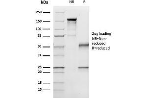 SDS-PAGE Analysis Purified p57 Mouse Monoclonal Antibody (57P06). (CDKN1C anticorps)