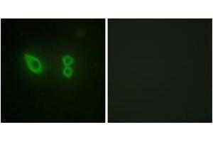 Immunofluorescence analysis of HeLa cells, using Actinin alpha-2/3 Antibody. (ACTN2/3 anticorps  (AA 31-80))