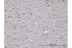 Immunoperoxidase of monoclonal antibody to RAD1 on formalin-fixed paraffin-embedded human lateral ventricle wall.