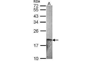 WB Image Sample (30 ug of whole cell lysate) A: Hela 12% SDS PAGE antibody diluted at 1:1000 (Endothelin 2 anticorps)