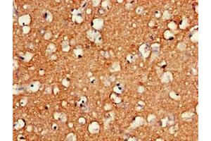 Immunohistochemistry of paraffin-embedded human brain tissue using ABIN7155209 at dilution of 1:100 (HMGB2 anticorps  (AA 43-185))