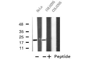 Western blot analysis of extracts from HeLa/COLO205 cells, using MRPL49 antibody.