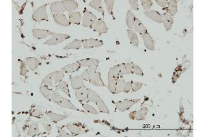 Immunoperoxidase of monoclonal antibody to HCAP-G on formalin-fixed paraffin-embedded human skeletal muscle. (NCAPG anticorps  (AA 336-435))
