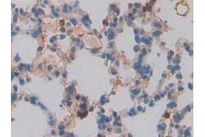 Detection of CCL6 in Rat Lung Tissue using Polyclonal Antibody to Chemokine (C-C motif) ligand 6 (CCL6)