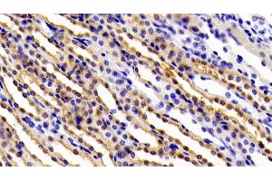 Detection of gp130 in Rat Kidney Tissue using Polyclonal Antibody to Glycoprotein 130 (gp130) (CD130/gp130 anticorps  (AA 26-323))