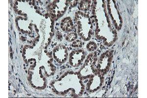 Image no. 3 for anti-Carboxypeptidase A2 (Pancreatic) (CPA2) antibody (ABIN1497598)