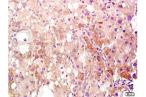 Formalin-fixed and paraffin embedded rat liver tissue labeled Anti-HMGB1 Polyclonal Antibody, Unconjugated (ABIN671616) at 1:400, followed by conjugation to the secondary antibody and DAB staining (HMGB1 anticorps  (AA 75-170))
