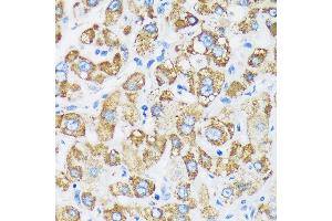 Immunohistochemistry of paraffin-embedded Human liver using GTPBP8 Rabbit pAb (ABIN7267527) at dilution of 1:100 (40x lens). (GTPBP8 anticorps  (AA 1-170))