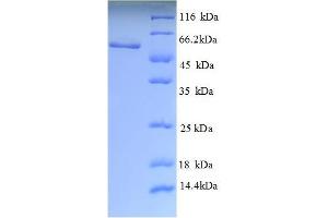 SDS-PAGE (SDS) image for Lecithin-Cholesterol Acyltransferase (LCAT) (AA 25-433), (partial) protein (His tag) (ABIN5712770)