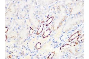 Immunohistochemistry of paraffin-embedded rat kidney using Aconitase 2   Rabbit mAb (ABIN7265379) at dilution of 1:100 (40x lens). (ACO2 anticorps)