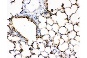 IHC analysis of SFTPA1 using anti- SFTPA1 antibody .