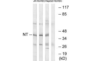 Western blot analysis of extracts from Jurkat cells, HUVEC cells and HepG2 cells, using NT antibody. (NT (C-Term) anticorps)