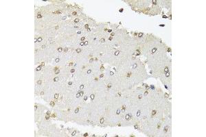 Immunohistochemistry of paraffin-embedded rat brain using POLR2B antibody.