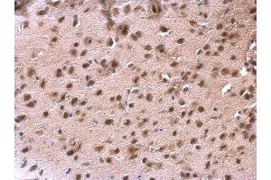 IHC-P Image DDX1 antibody [N3C2], Internal detects DDX1 protein at nucleus on mouse fore brain by immunohistochemical analysis. (DDX1 anticorps  (Internal Region))