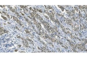 IHC analysis of eRF1/ETF1 using anti-eRF1/ETF1 antibody (ABIN7602625). (ETF1 anticorps  (AA 9-342))
