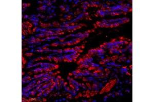 Immunofluorescence of paraffin embedded rat lung using C1orf173 (ABIN7074073) at dilution of 1: 650 (350x lens) (Glutamate-Rich Protein 3 (ERICH3) anticorps)
