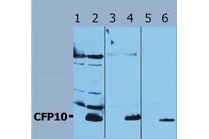 Western Blotting (Mycobacterium Tuberculosis Antigen CFP10 (Rv3874) anticorps)