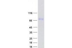 Validation with Western Blot