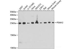 Western blot analysis of extracts of various cell lines using PSMA2 Polyclonal Antibody at dilution of 1:1000. (PSMA2 anticorps)