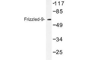 Image no. 1 for anti-Frizzled Family Receptor 9 (FZD9) antibody (ABIN317735) (FZD9 anticorps)