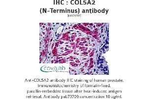 Image no. 1 for anti-Collagen, Type V, alpha 2 (COL5A2) antibody (ABIN1733201) (COL5A2 anticorps)
