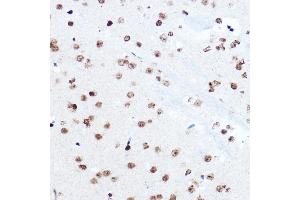 Immunohistochemistry of paraffin-embedded mouse brain using SETD5 Rabbit pAb (ABIN6132960, ABIN6147644, ABIN6147646 and ABIN6223140) at dilution of 1:100 (40x lens). (SETD5 anticorps  (AA 520-740))