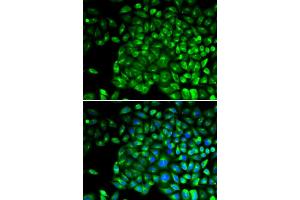 Immunofluorescence analysis of U2OS cells using TNFR2/TNFR2/TNFRSF1B antibody (ABIN1683061, ABIN3015125, ABIN3015126 and ABIN6213832). (TNFRSF1B anticorps  (AA 30-250))