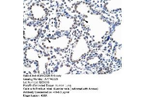 ARP40336 Paraffin Embedded Tissue: Human Lung Cellular Data: Alveolar cells Antibody Concentration: 4. (KIAA0020 anticorps  (N-Term))