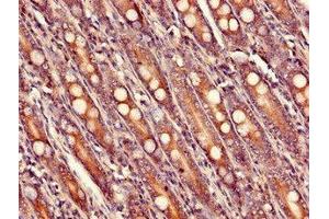 Immunohistochemistry of paraffin-embedded human small intestine tissue using ABIN7175150 at dilution of 1:100 (USHBP1 anticorps  (AA 1-260))