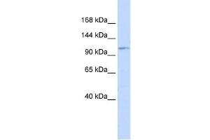 Western Blot showing AVIL antibody used at a concentration of 1-2 ug/ml to detect its target protein. (Advillin anticorps  (Middle Region))