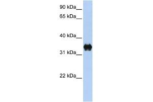WB Suggested Anti-PYCR2 Antibody Titration: 0.