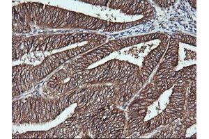 Image no. 2 for anti-Musashi Homolog 2 (MSI2) antibody (ABIN1499578)