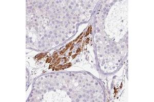 Immunohistochemical staining of human testis shows strong cytoplasmic positivity in Leydig cells. (FGF17 anticorps)