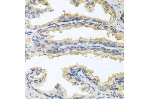 Immunohistochemistry of paraffin-embedded human prostate using OSM antibody. (Oncostatin M anticorps)