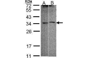 WB Image Sample (30 ug of whole cell lysate) A: 293T B: Raji 12 % SDS PAGE antibody diluted at 1:1000 (FHL5 anticorps)