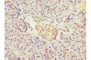 Immunohistochemistry of paraffin-embedded human pancreatic tissue using ABIN7149054 at dilution of 1:100 (CRIP2 anticorps  (AA 1-208))