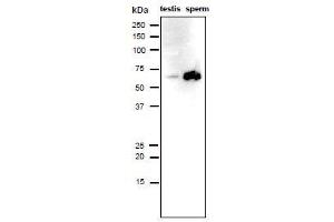 Western Blotting (WB) image for anti-Izumo Sperm-Egg Fusion 1 (IZUMO1) antibody (ABIN2452040) (IZUMO1 anticorps)