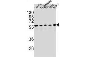 Western Blotting (WB) image for anti-Paired Box 1 (PAX1) antibody (ABIN2995657)