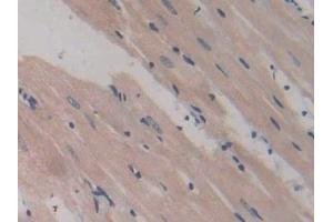Detection of GP9 in Rat Heart Tissue using Polyclonal Antibody to Glycoprotein IX, Platelet (GP9)