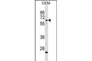 C8B Antibody (C-term) (ABIN1881130 and ABIN2838764) western blot analysis in CEM cell line lysates (35 μg/lane). (C8B anticorps  (C-Term))
