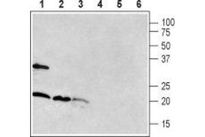 Western blot analysis of rat brain (lanes 1 and 4), mouse brain (lanes 2 and 5) and rat pancreas (lanes 3 and 6): - 1-3. (RAMP1 anticorps  (Extracellular, N-Term))