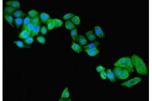 Immunofluorescent analysis of PC-3 cells using ABIN7154647 at dilution of 1:100 and Alexa Fluor 488-congugated AffiniPure Goat Anti-Rabbit IgG(H+L)