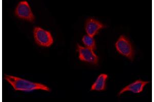 ABIN6264754 and ABIN6273309 staining Hela by IF/ICC.