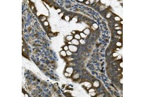 IHC analysis of UNG using anti UNG antibody (ABIN7602695).