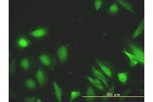Immunofluorescence of monoclonal antibody to DNAJA2 on HeLa cell.