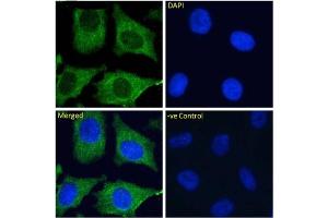 Immunofluoresence staining of fixed HeLa cells with anti-DC-SIGNR antibody 16E7.